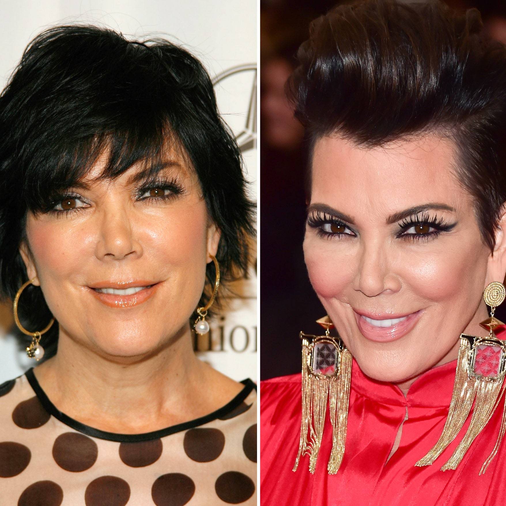 Kris jenner: before and after 2022