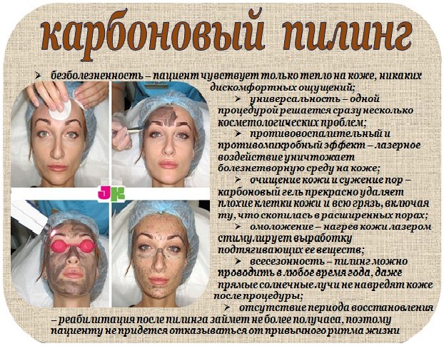Карбоновый пилинг кожи: суть и описание процедуры