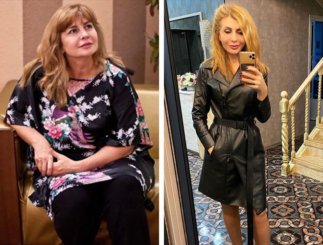Ирина александровна до и после операции. ирина агибалова – неудачная пластическая операция, фото до и после. личная жизнь ирины агибаловой
