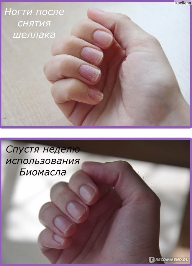 Как восстановить ногти после гель-лака в домашних условиях?