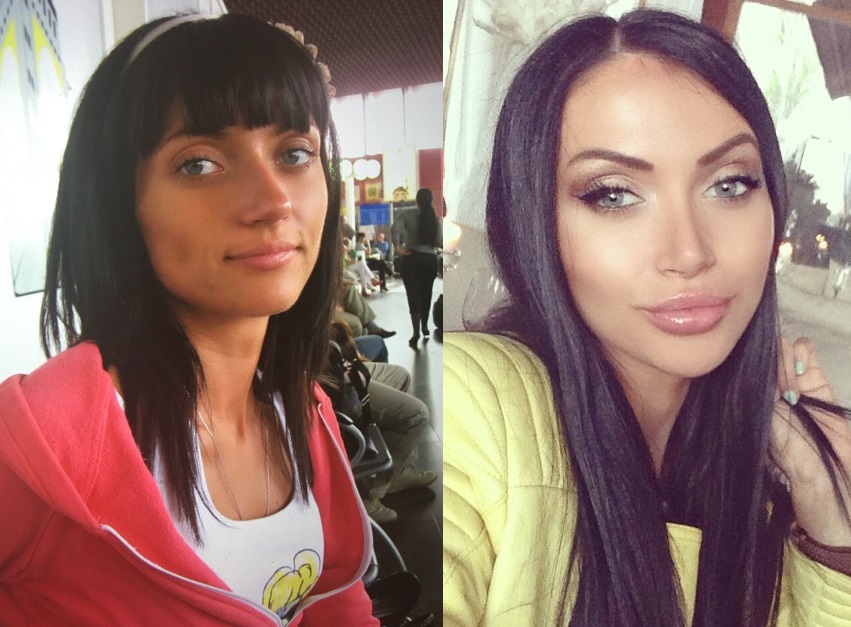 Марина майер до и после пластики