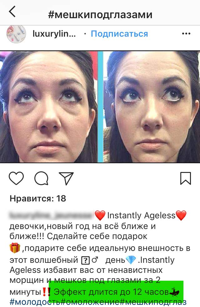 Как убрать мешки и синяки под глазами дома