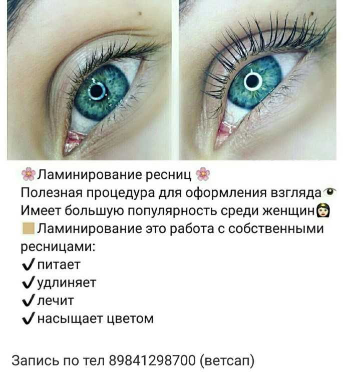 Минусы Наращивания Ресниц Фото