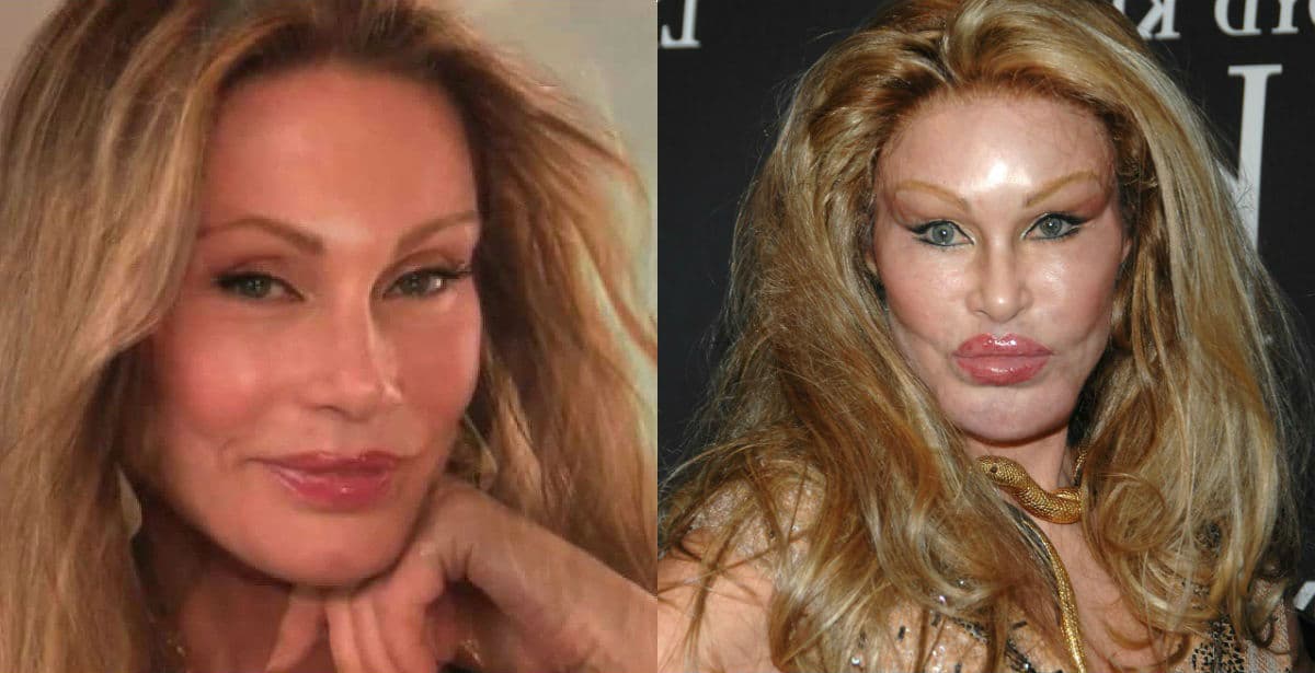 Jocelyn wildenstein plastic surgery before and after pictures 2024
