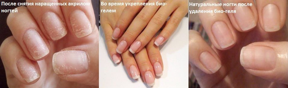 Основные отличия геля-лака от биогеля. биогель или шеллак: что лучше для ногтей