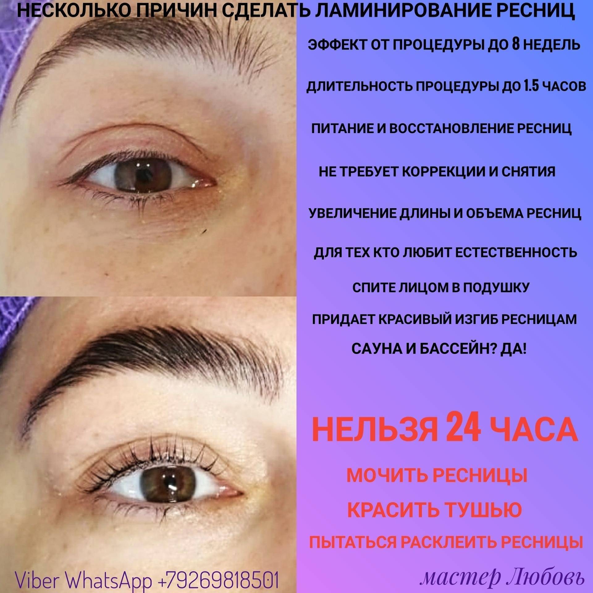 Как и для чего делается ботокс для бровей