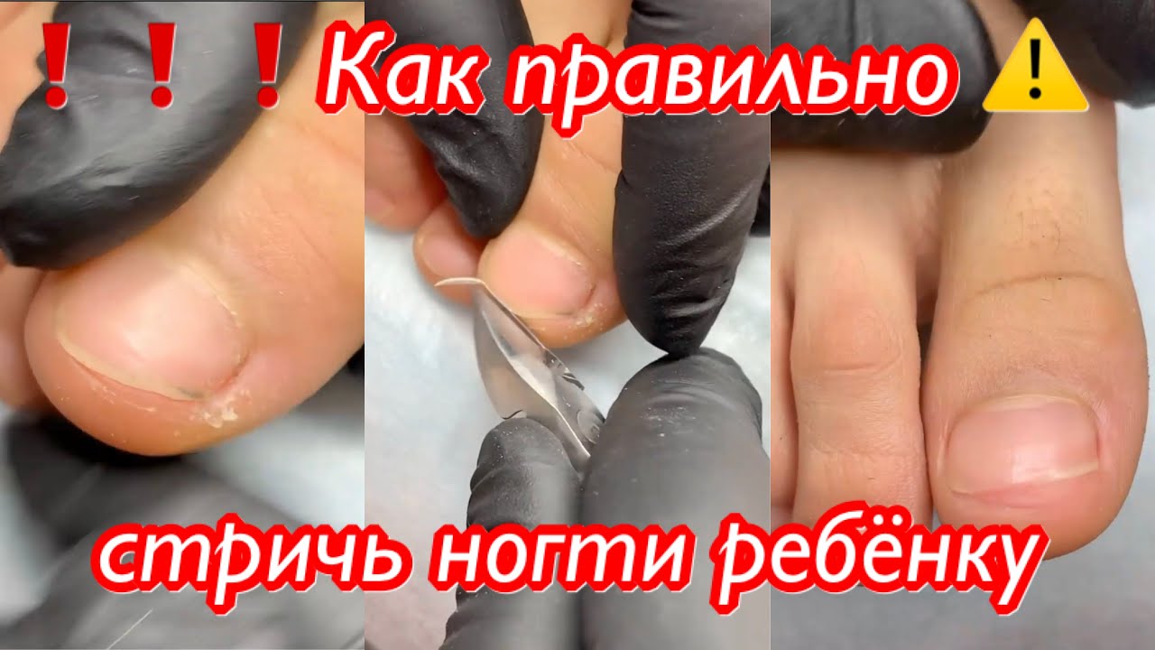 Как стричь ногти ребенку