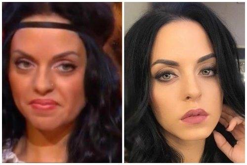 Юлия ефременкова до и после пластики с примером фото