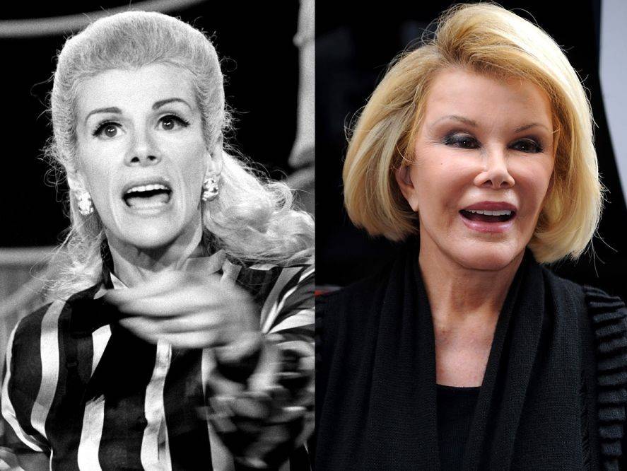 Joan rivers before and after surgeries and her death