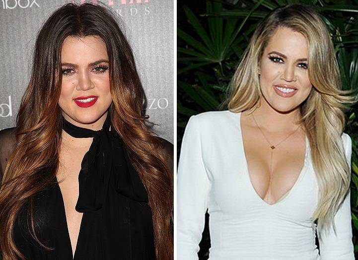 Фигура на миллион: все пластические операции семейства кардашьян