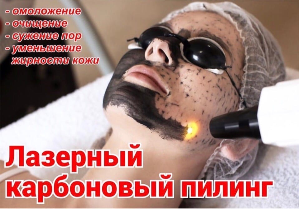 Карбоновый пилинг- избавляемся от многих изъянов кожи