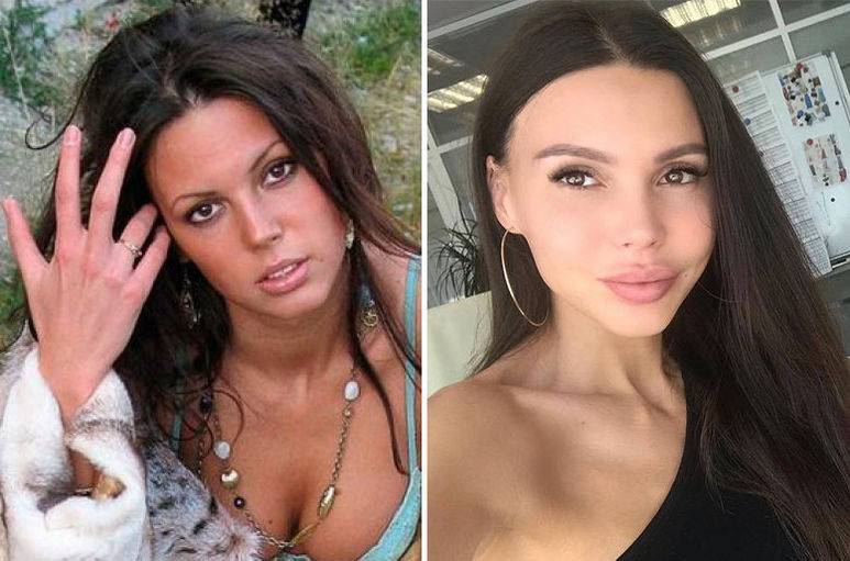 Самойлова до и после – самойлова оксана до пластики и после. биография и личная жизнь оксаны самойловой :: syl.ru