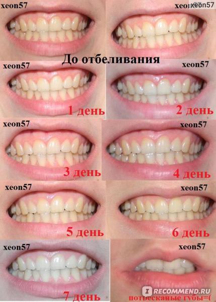 Отбеливание зубов маслом чайного дерева