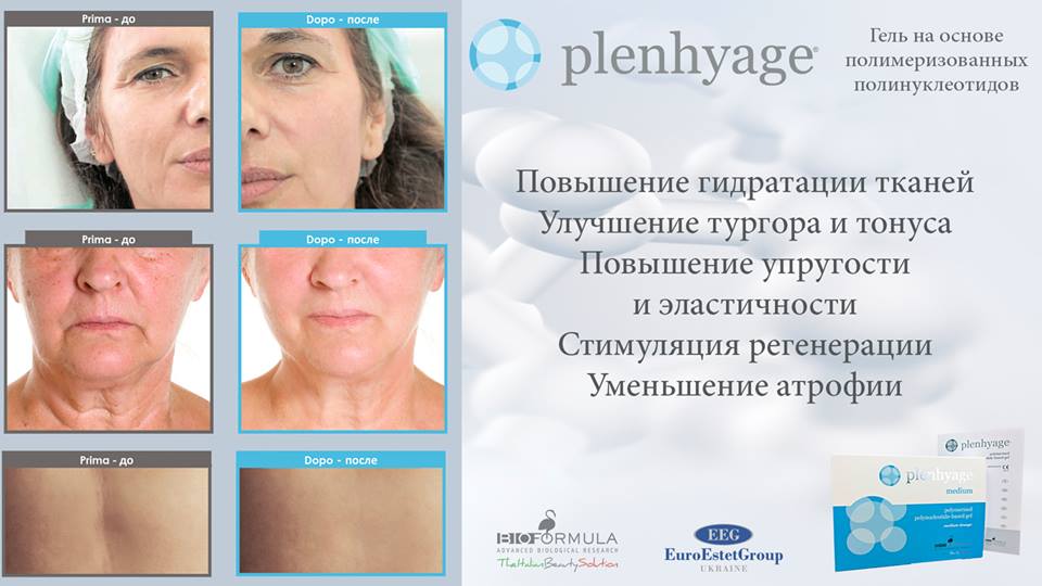 Полинуклеотиды в инъекционной косметологии. Препараты, цены, где купить