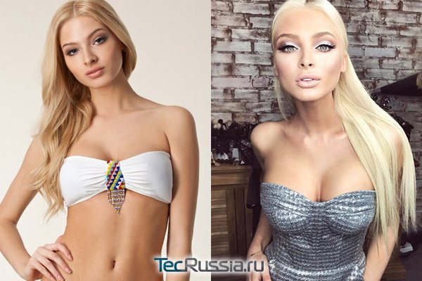 Шишкова: до и после пластики +фото: биография и в чем секрет красоты алены шишковой?