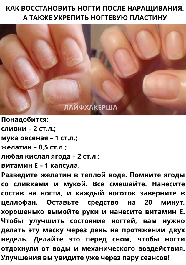 Как ускорить рост ногтей: маски, ванночки и косметика