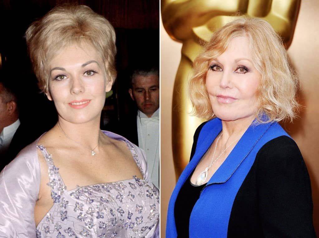 Kim novak plastic surgery before and after pictures