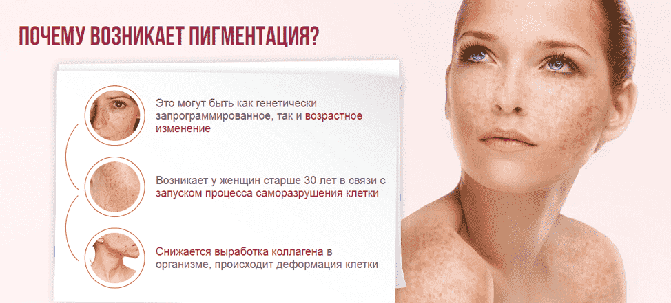 Пигментные пятна на теле: виды, причины появления и методы лечения