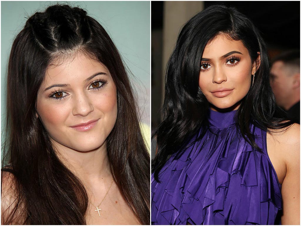 Kylie jenner, before and after transformation