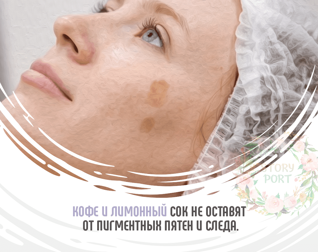 Как избавиться от пигментных пятен на лице в домашних условиях