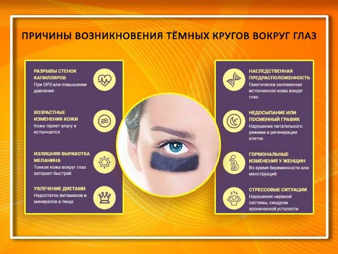 Почему возникают синяки под глазами?