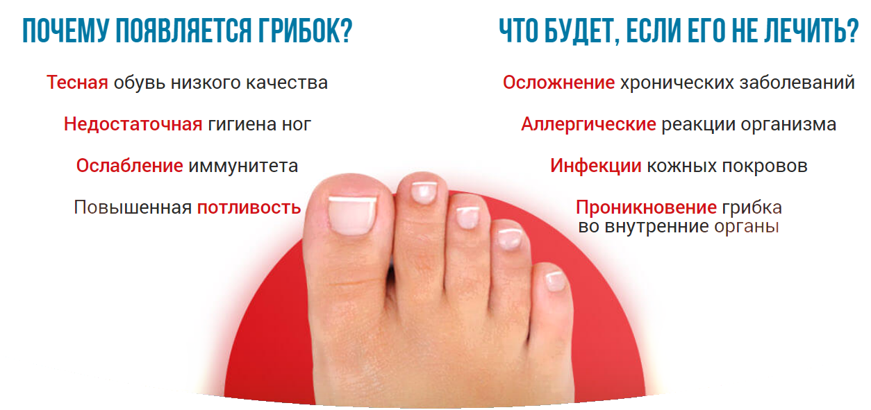 Болезни ногтей: причины, симптомы и лечение