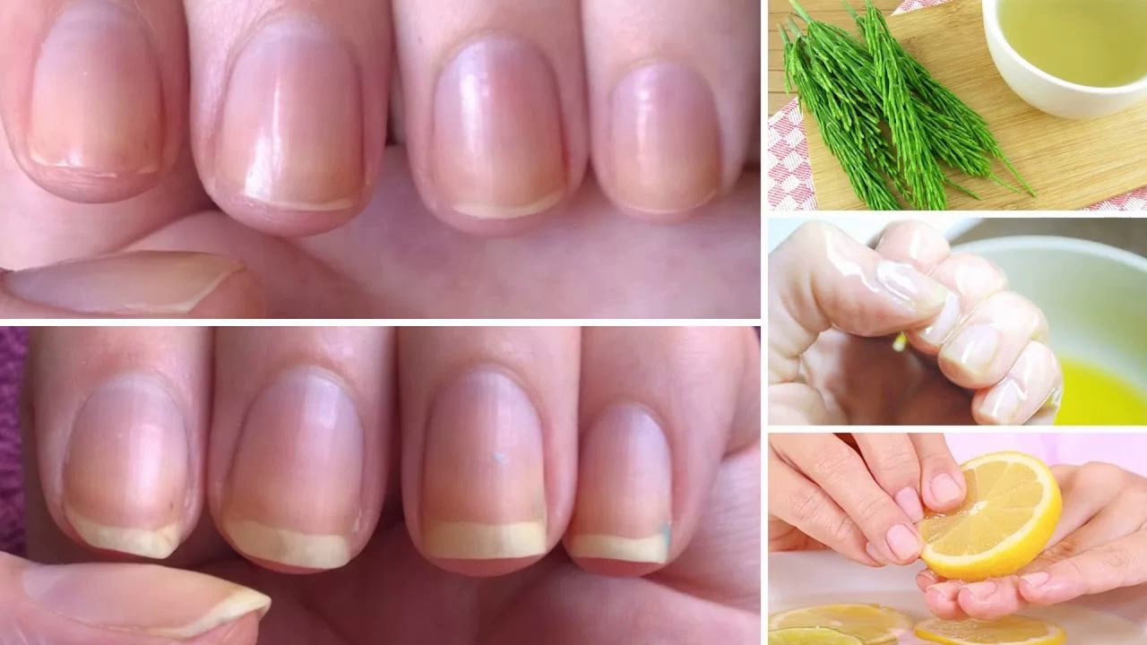 Процедуры для укрепления ногтей дома. простые ванночки и маски.