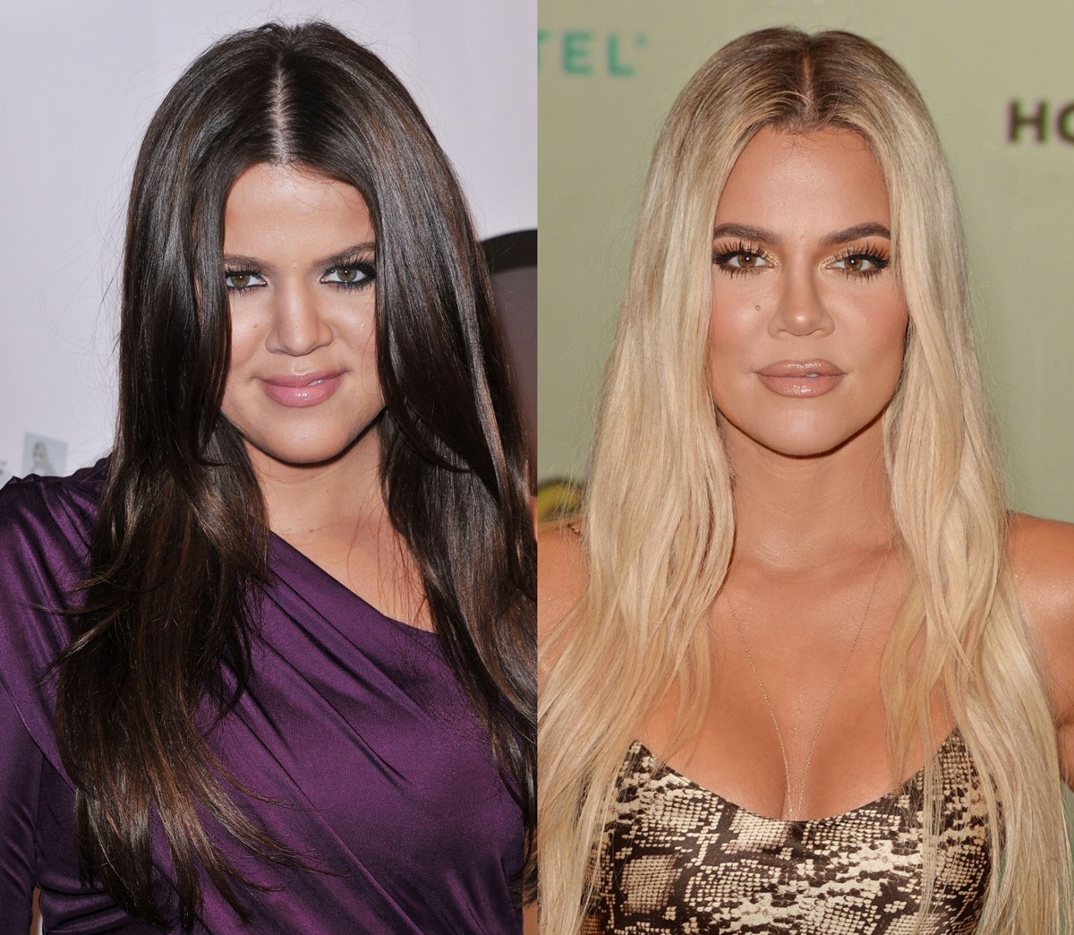 Бьюти-эволюция семейства кардашьян: на какие операции решились звезды реалити-шоу