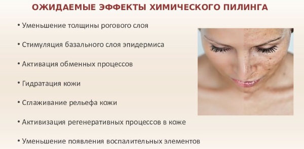 Химический пилинг лица – плюсы и минусы процедуры