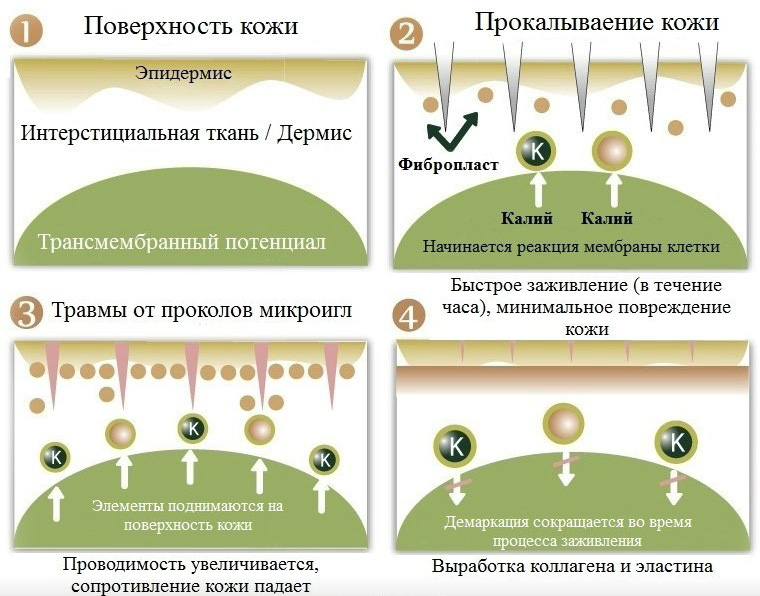 Фракционная мезотерапия кожи лица: подробное описание, противопоказания, ход выполнения, аппаратный вид, осложнения, эффективность