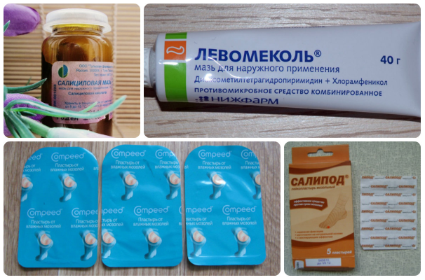 Мозоль между пальцев ног: чем лечить