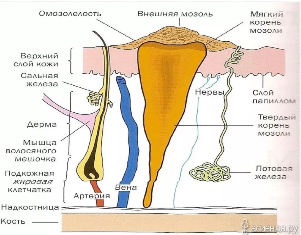 Мозоли на ногах (стопах) — причины, лечение | медицинский центр да!