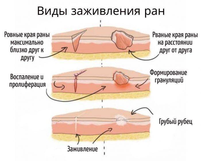 Раны на лице: быстрое заживление и лечение, правила ухода