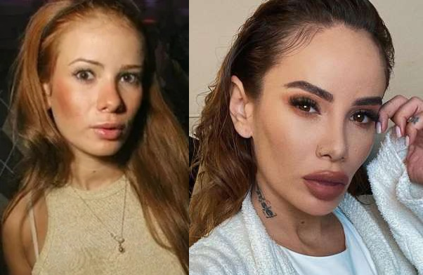 Айза анохина- пластические операции и личная жизнь блогера