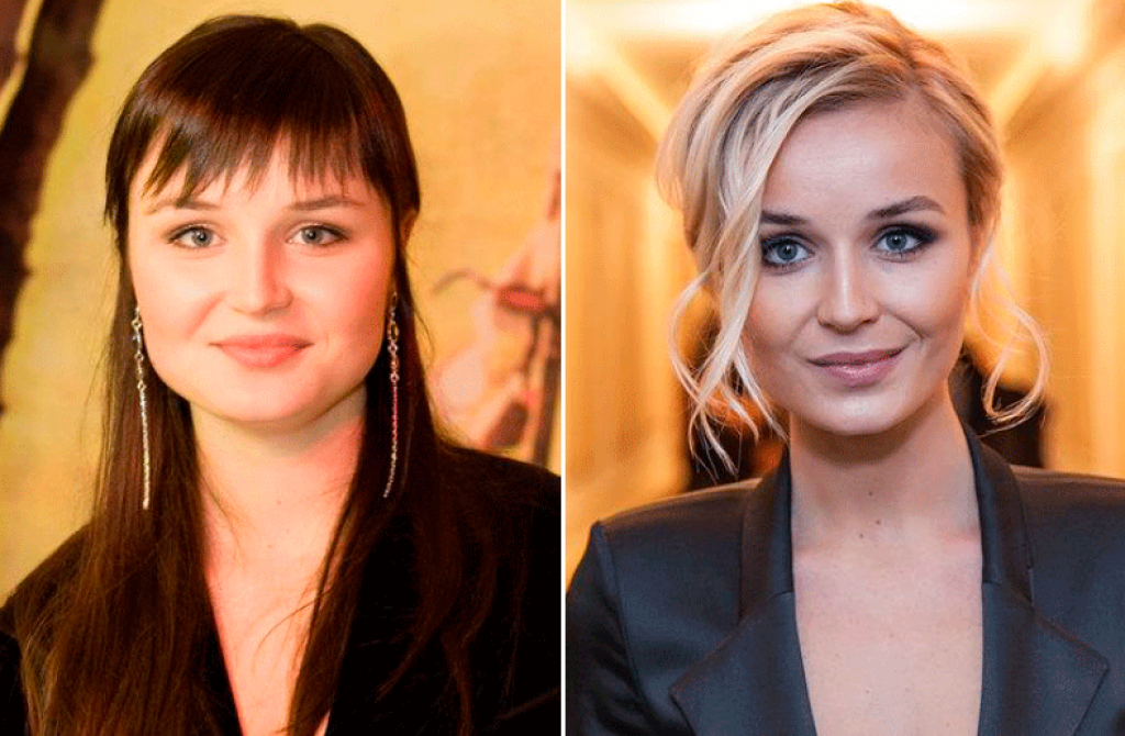 Делала ли пластику полина гагарина, фото до и после похудения