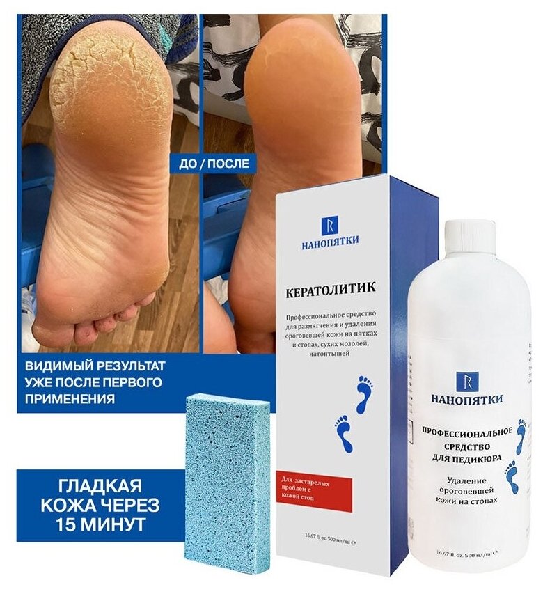 ᐉ кератолитик для педикюра как использовать - salon-nagorkogo.ru