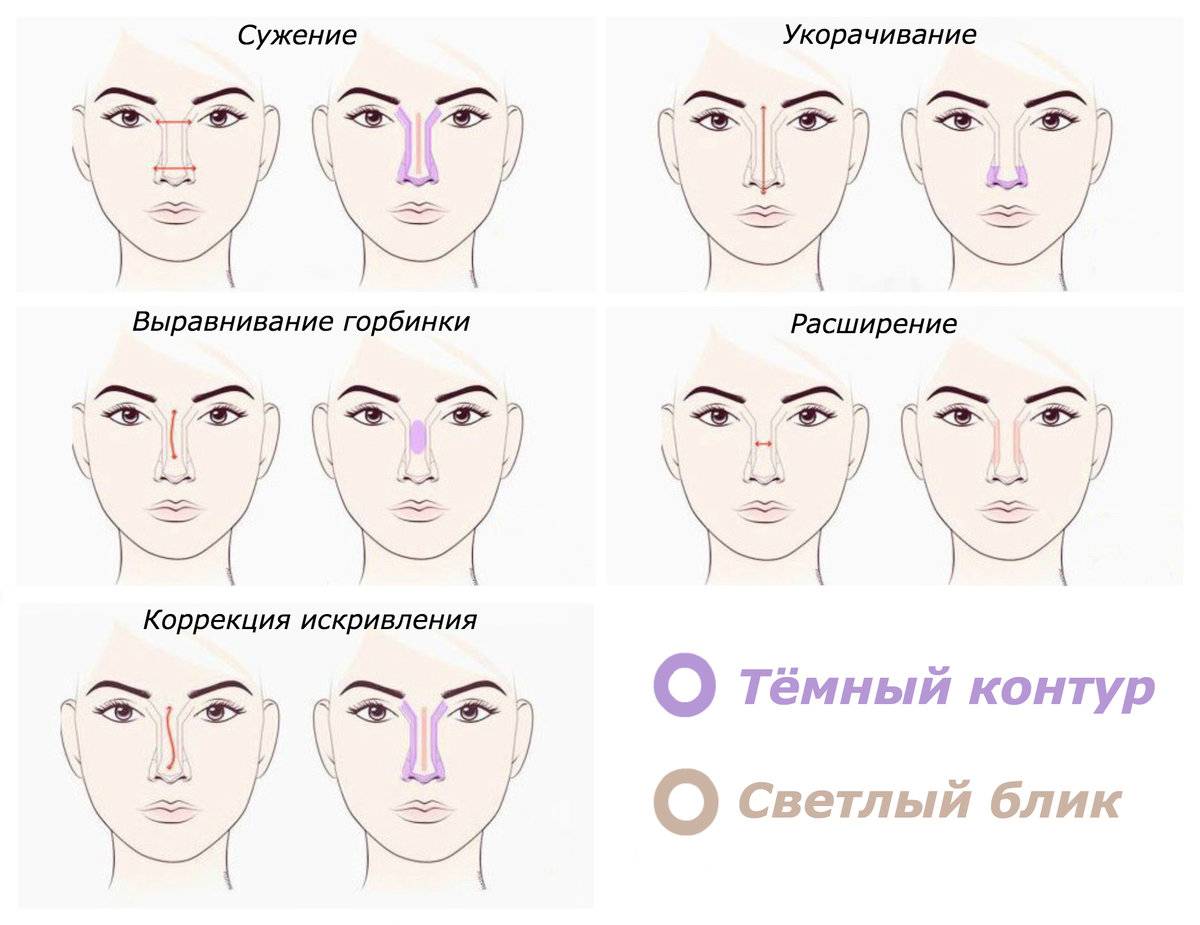 Форма носа: какой может быть и какие есть методы коррекции