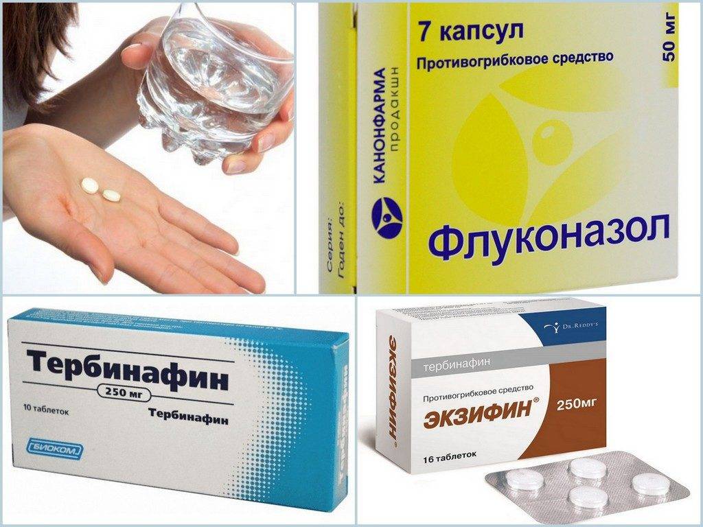 Рейтинг средств от грибка ногтей