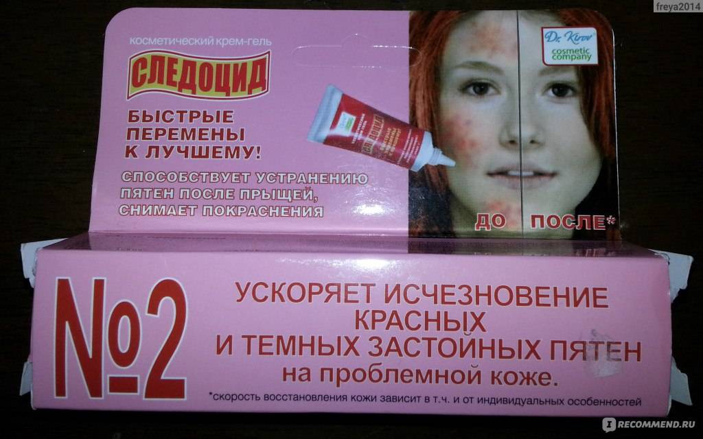 Застойные пятна: 9 кремов, мазей, аптечных средств от следов после прыщей, чем убрать