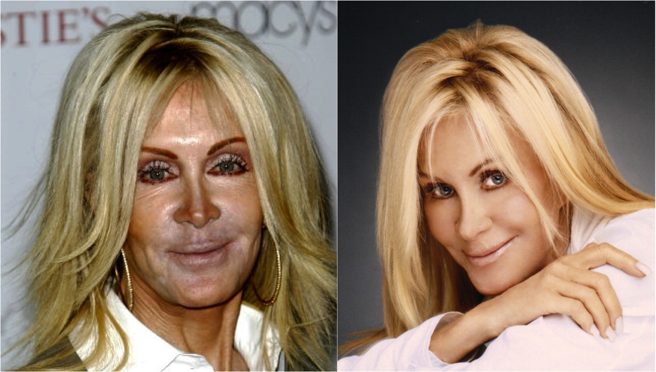 Joan van ark plastic surgery: the knots landing star then and now!
