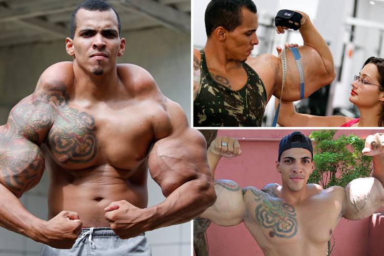 Кто такой «мистер синтол» кирилл терешин и почему все о нем говорят. он «накачал» огромные бицепсы с помощью инъекций. не пытайтесь это повторить. «мистер синтол» кирилл терешин избавился от огромных бицепсов мистер синтол кирилл терешин