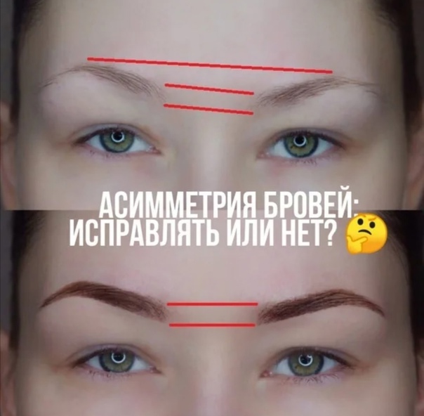 Асимметрия бровей – как исправить? - леди молодость