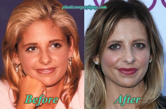 Sarah michelle gellar bio, affair, relationship, married, net worth