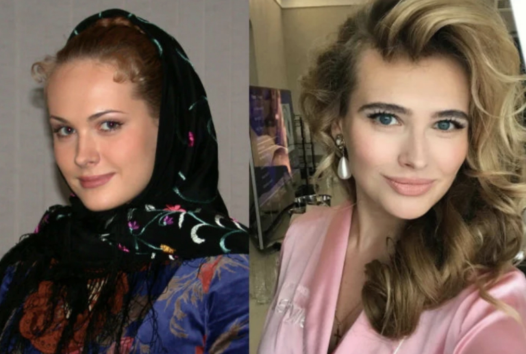 Анна горшкова до и после пластики что изменила личная жизнь