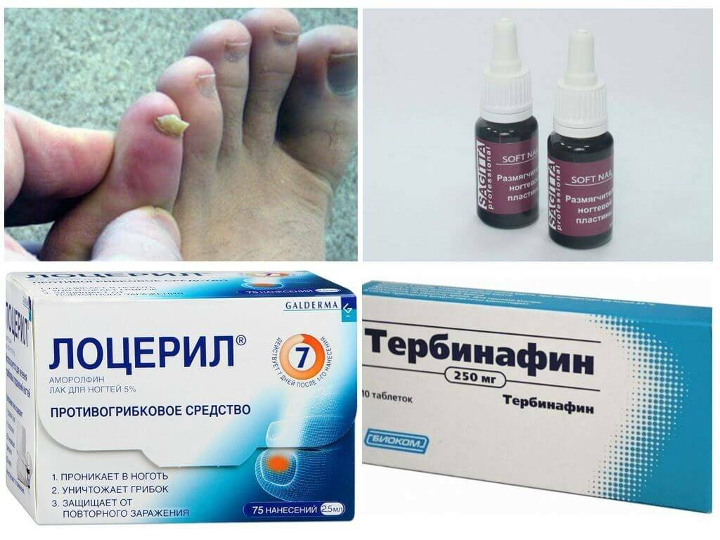 Недорогие, но эффективные противогрибковые таблетки