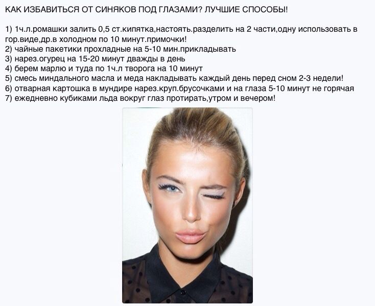 Как избавиться от синяка под глазом от удара, рецепты и советы
