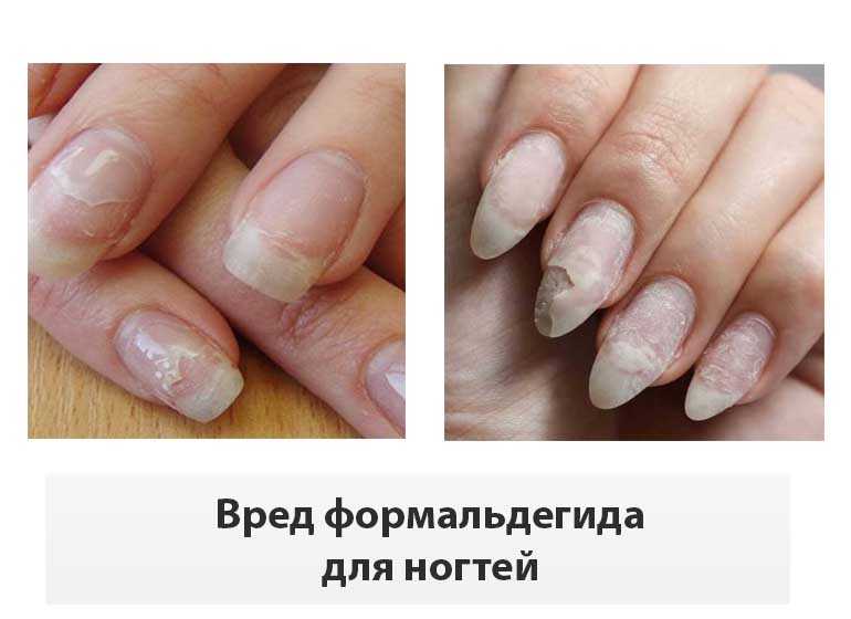 Вреден ли для ногтей гель-лак - вред состава, насколько вредит его постоянное использование