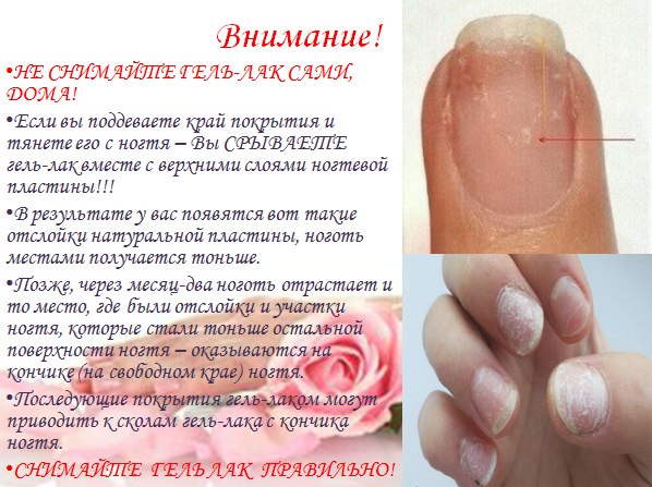 Можно ли красить ногти гель-лаком при беременности. вреден ли гель-лак во время беременности