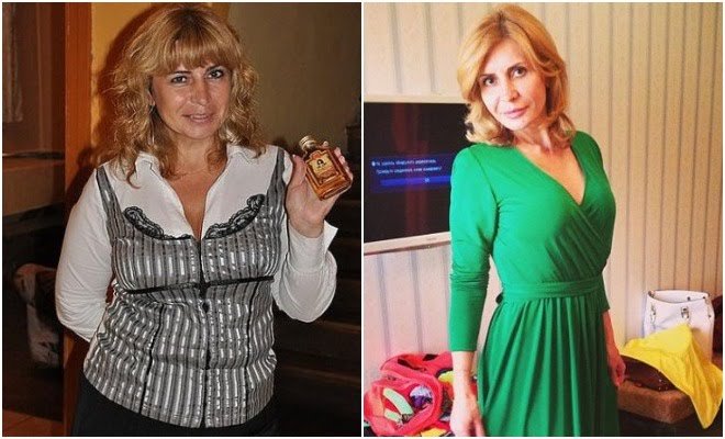 Самые дикие пластические операции участников «дома-2»