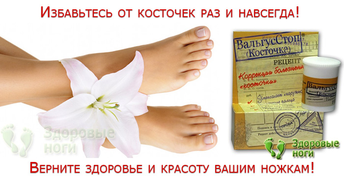 Помогает ли валгус про